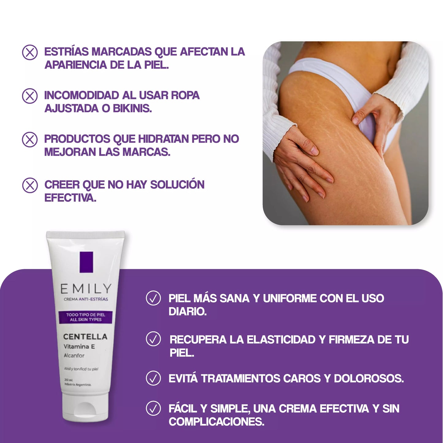 Crema para Estrías EMILY 200ml🧴🦵 con Jojoba, B5 y Ácido Hialurónico