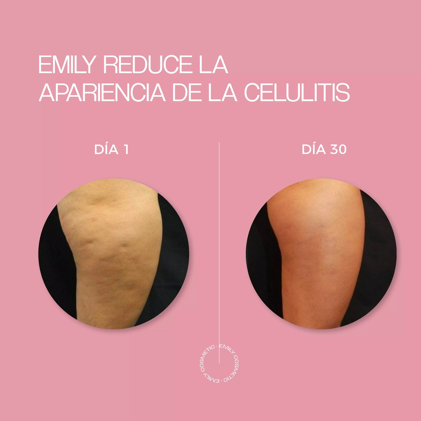 Crema para Celulitis EMILY 200ml🧴🦵 con Centella y Vitamina E