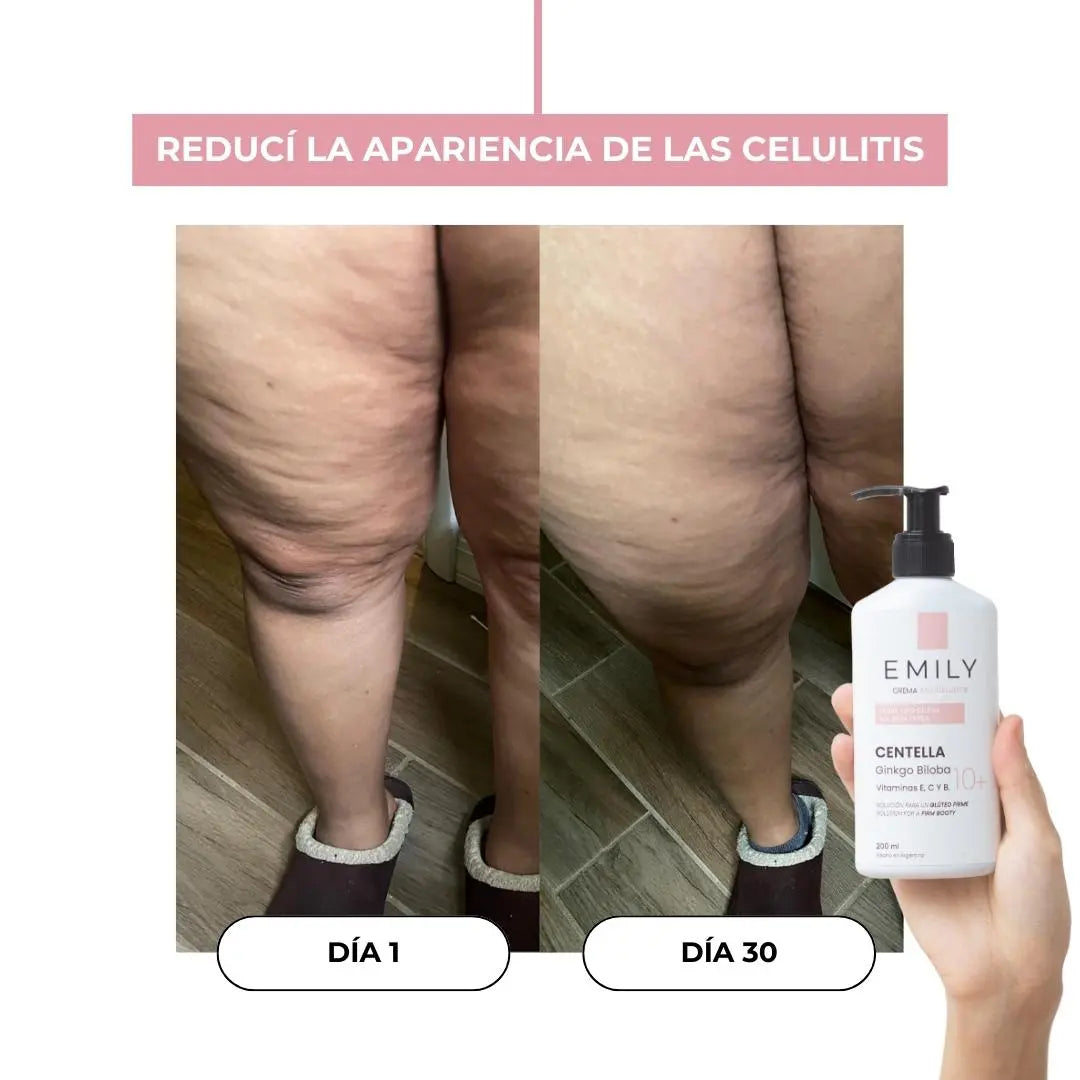 Cómo reducir la celulitis