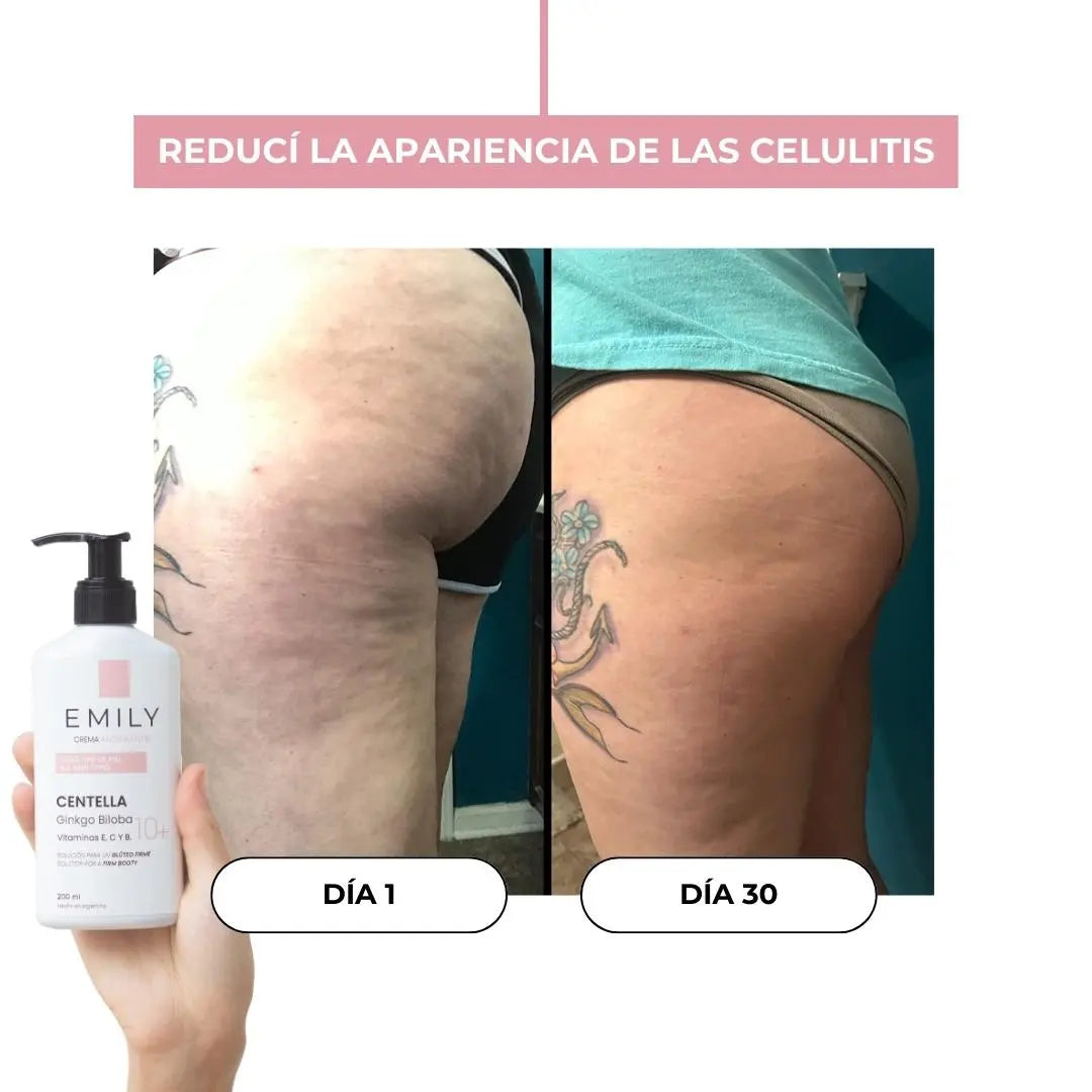 Reducir la celulitis