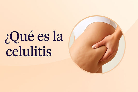 Qué es la celulitis: causas, tipos y tratamientos efectivos en Argentina