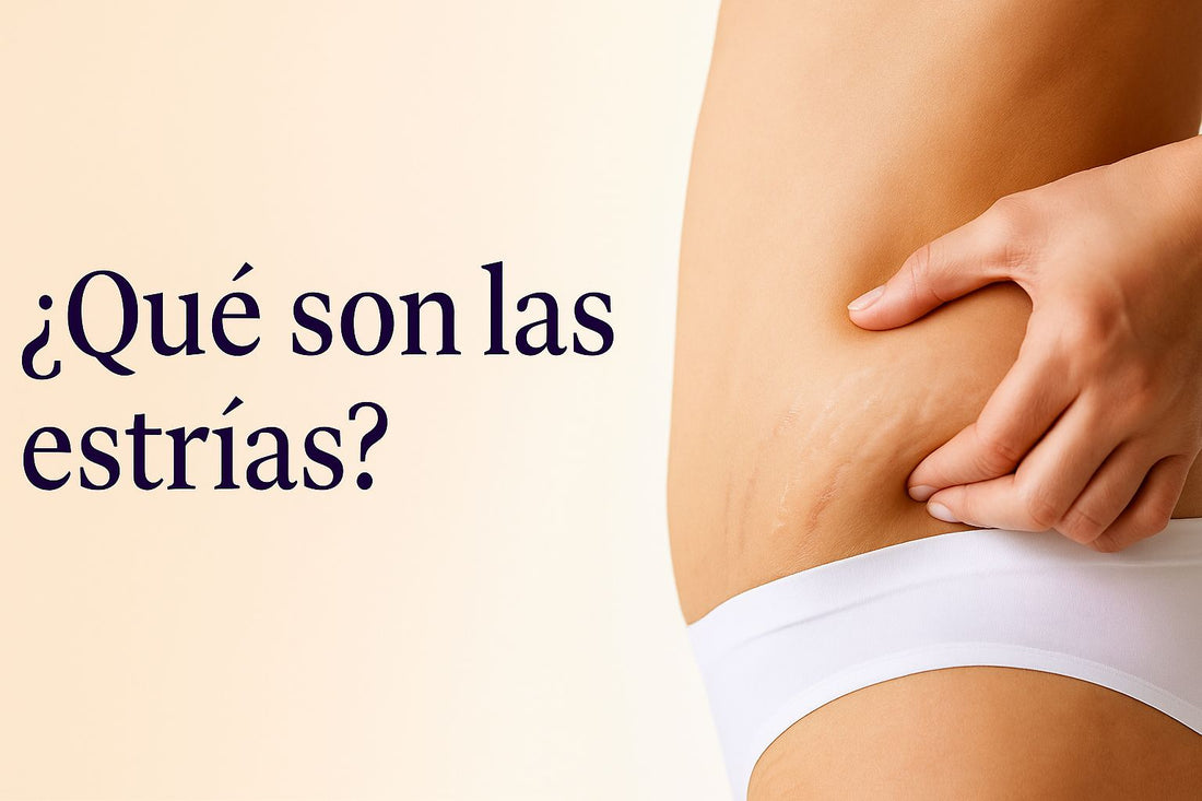 Qué son las estrías, por qué aparecen y cómo tratarlas [Guía 2025]