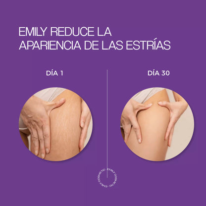 Crema para Estrías EMILY 200ml🧴🦵 con Jojoba, B5 y Ácido Hialurónico