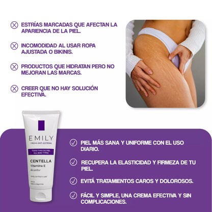 Crema para Estrías EMILY 200ml🧴🦵 con Jojoba, B5 y Ácido Hialurónico