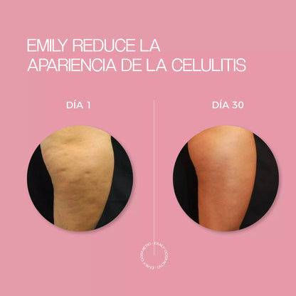 Crema para Celulitis EMILY 200ml🧴🦵 con Centella y Vitamina E