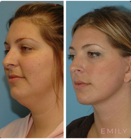 Face Yoga Plan Personal | Tu Plan de Ejercicios Faciales para Rejuvenecer