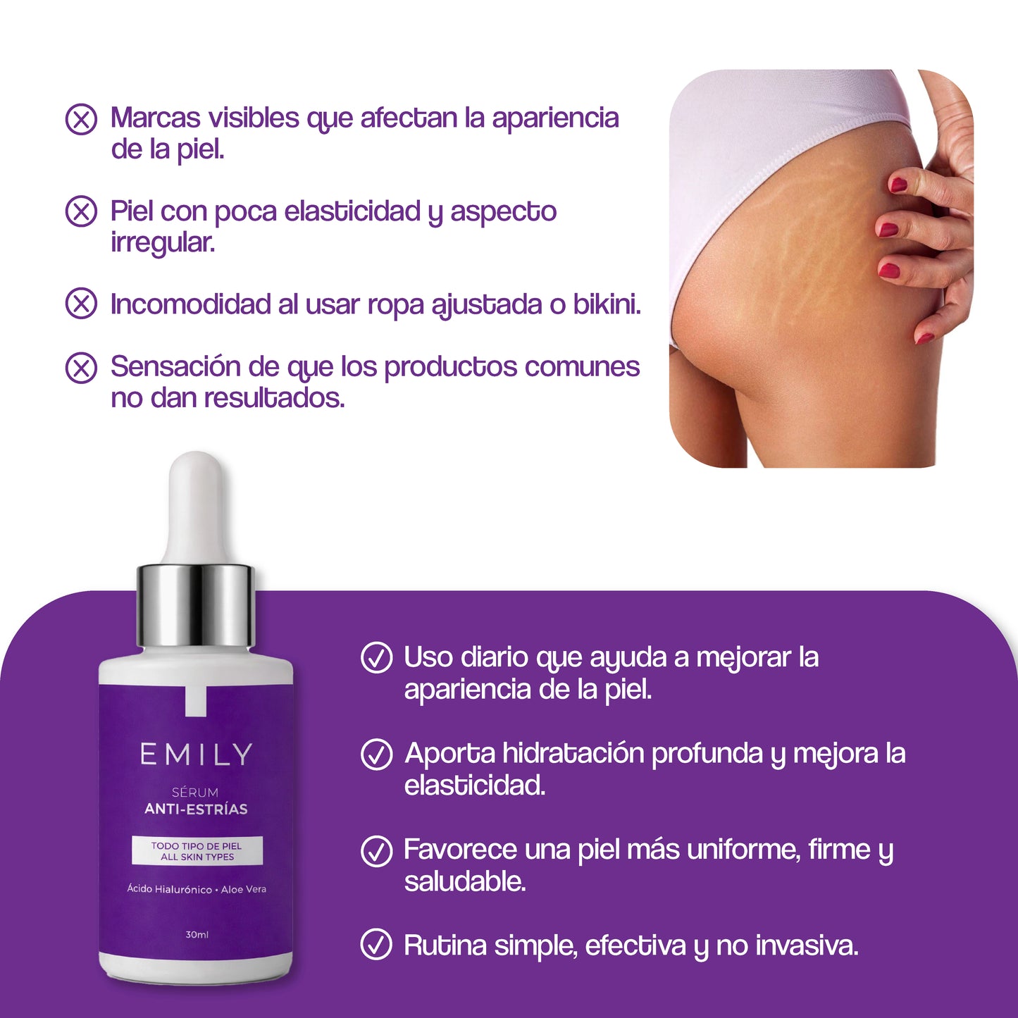 Sérum Anti-Estrías con Ácido Hialurónico, Aloe Vera y Ortiga - 30 ml