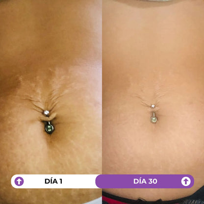 Combo Serums Confianza