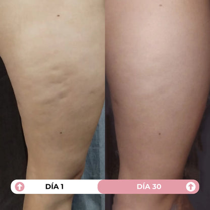 Combo Serums Confianza