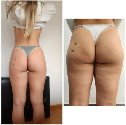 Resultado de clienta Emily